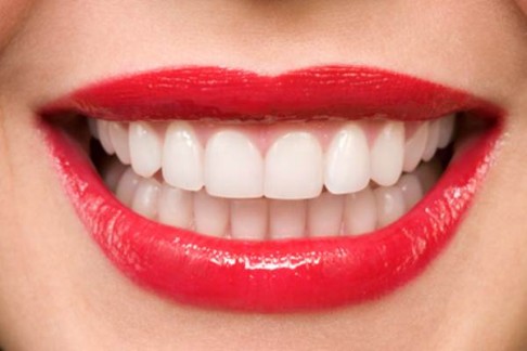  خلطات برازيلية لتبييض الأسنان…ستبهرك نتائجها!  Les-dentssss-486x324