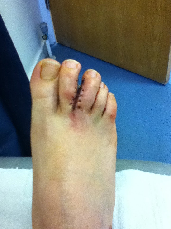 nike with toe separation