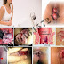 Nyeri Bengkak Di Bibir Dubur Tapi Tidak Berdarah thumbnail