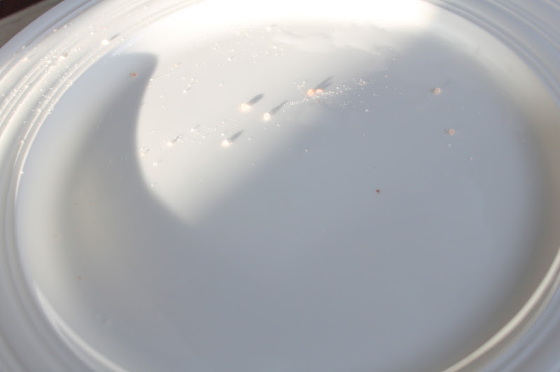 Braces and Rubber Bands