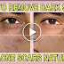 End Your Problem With Dark Spots Without Spending Money Using These Ingredients