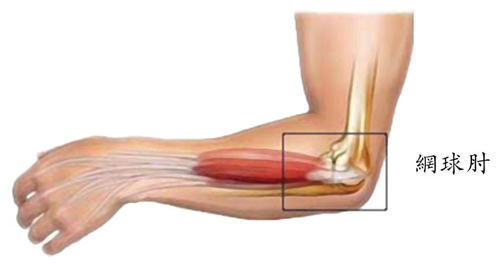 土豆仁體態平衡工房 健康小運動 手肘肌群伸展