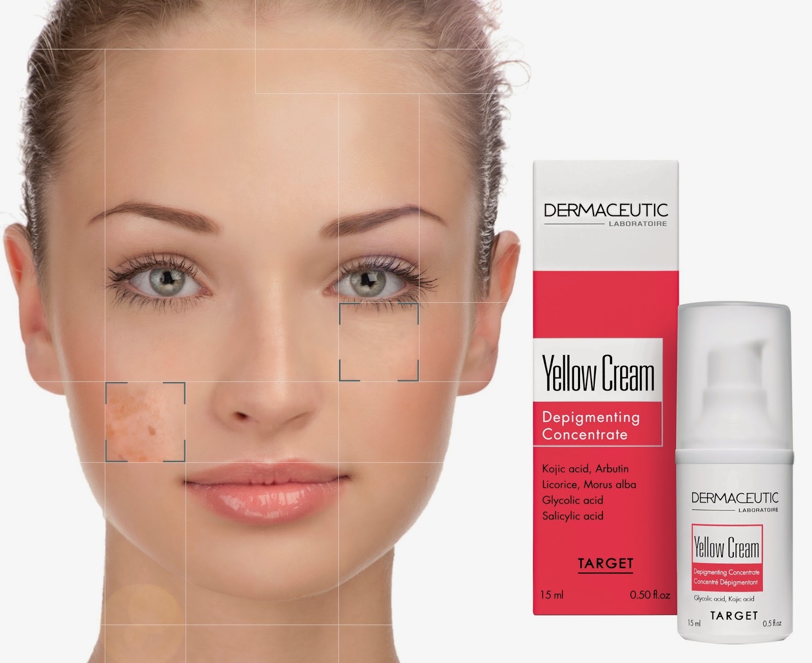 DERMACEUTIC YELLOW CREAM ile GÜNEŞ LEKELERİNE ELVEDA Hüzün Sarısı