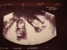 Actualmente ya soy madre de 2 preciosos bebes, que nacieron el 11-8-2011.