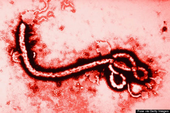 Ebola bite