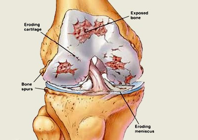 effected joint