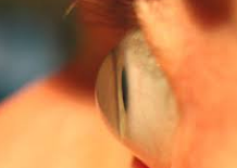 scleral lenses jupitor or