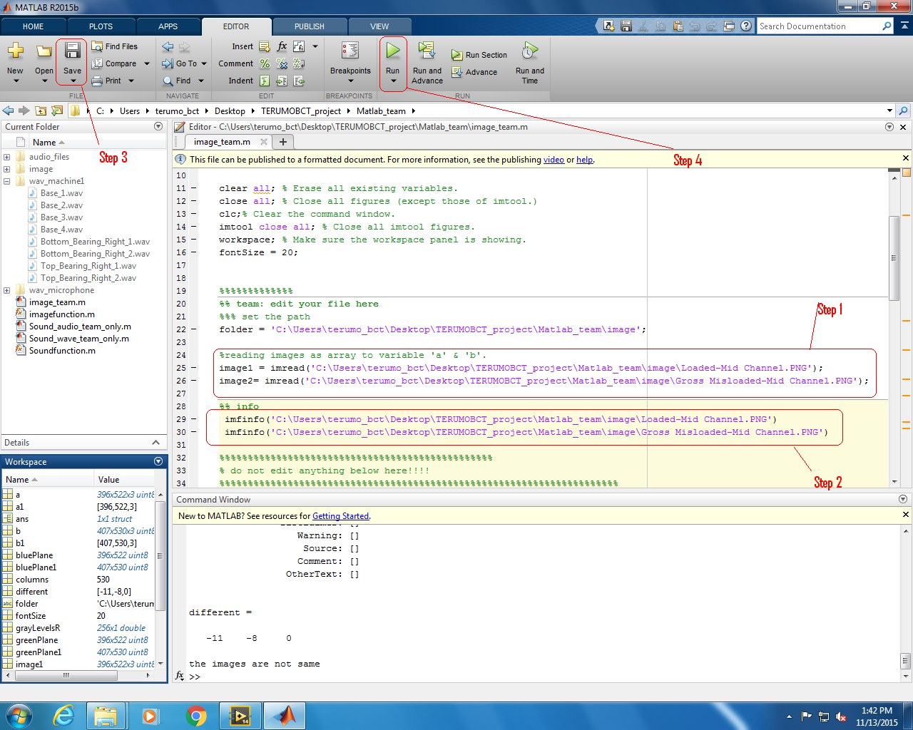 Biomedical Signal and Image Processing projects using Matlab and ...