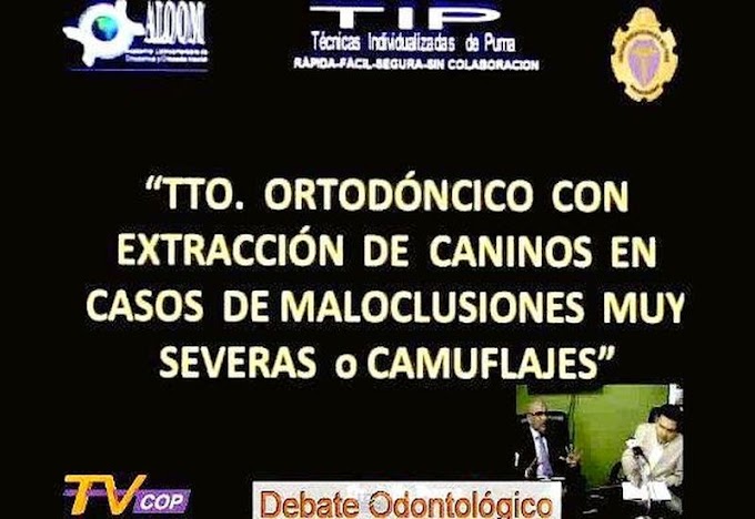 ENTREVISTA: Tratamiento ortodóntico con extracción de caninos - Dr. Julio Puma