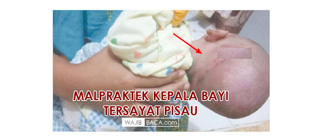 Suasana Haru Pemakaman 3 Anak yang Meninggal Akibat Racun Serangga, Begini Kondisi Ibunya Suasana Haru Pemakaman 3 Anak yang Meninggal Akibat Racun Serangga, Begini Kondisi Ibunya