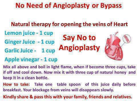 Say no to angioplasty randommusings.filminspector.com