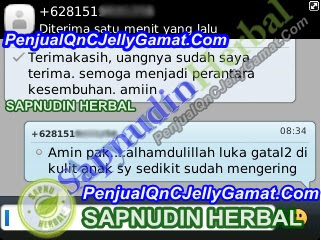 Cara Mengobati Gatal Akibat Biang Keringat Sampai Tuntas Cara Mengobati Gatal Akibat Biang Keringat Sampai Tuntas