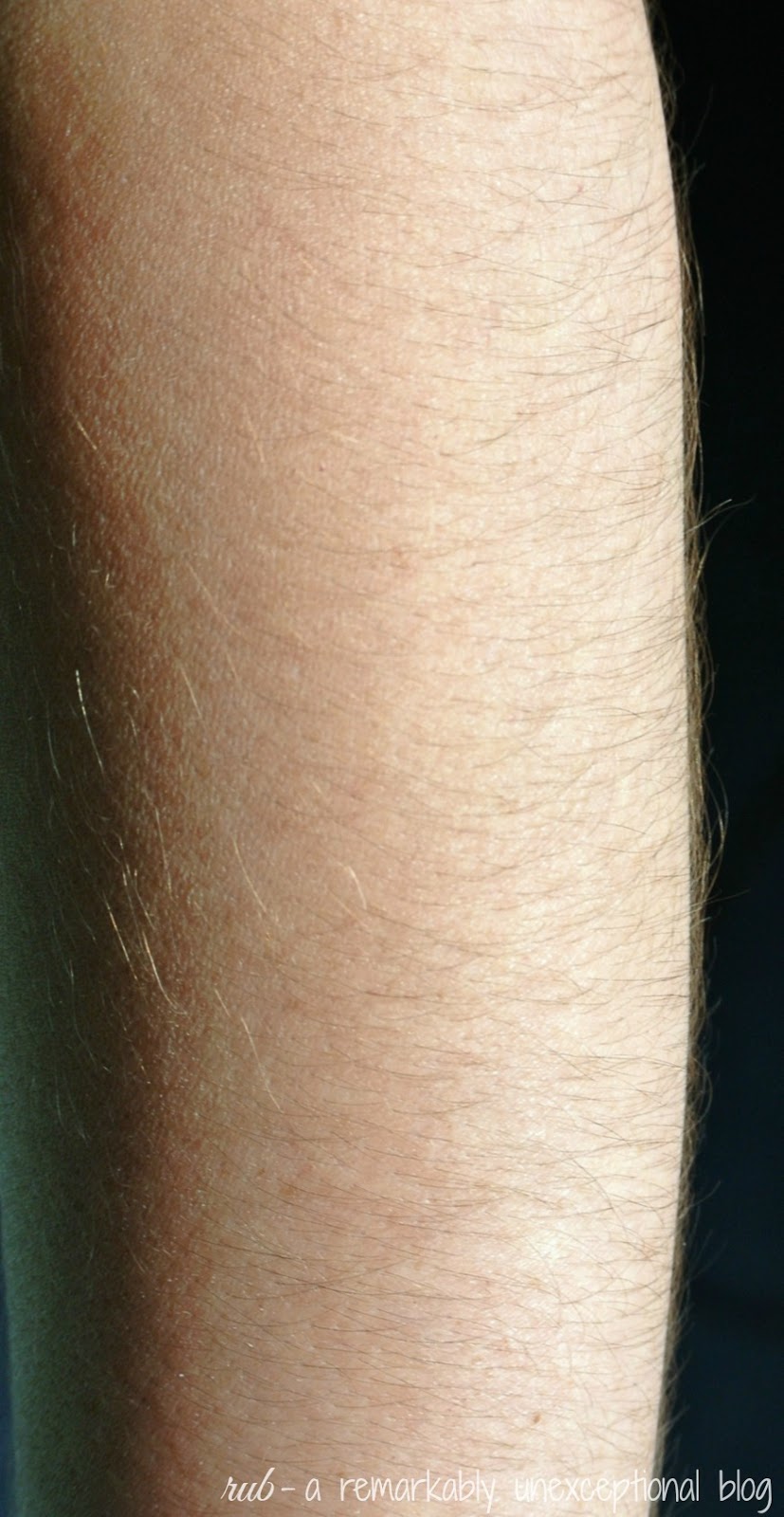 Arm Hair Removal for Women Edmund Designs