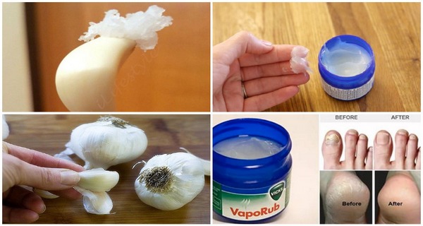 Put Some Vicks Vaporub On A Garlic Clove.