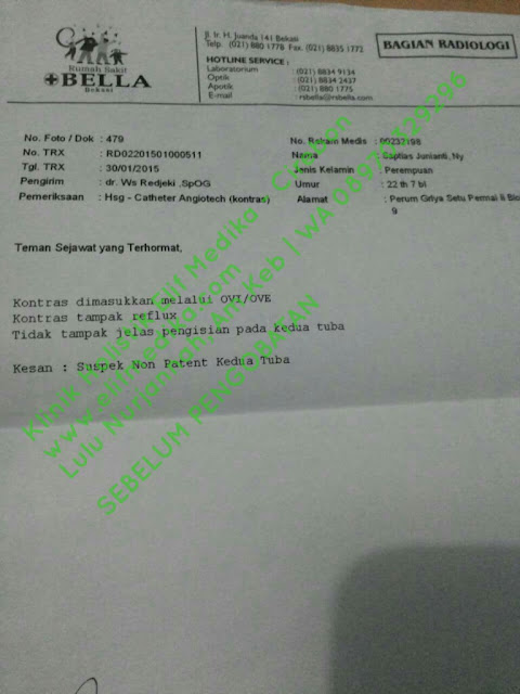Sebelum pengobatan : Suspek Non Paten kedua Tuba Sebelum pengobatan : Suspek Non Paten kedua Tuba