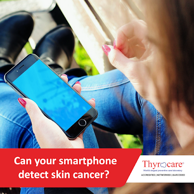 Can your smartphone detect skin cancer