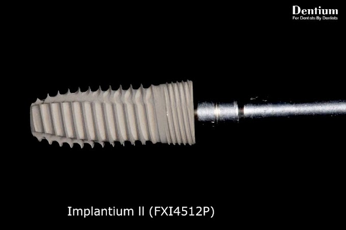 DENTAL MATERIALS: Implantium ll - Dentium New Product