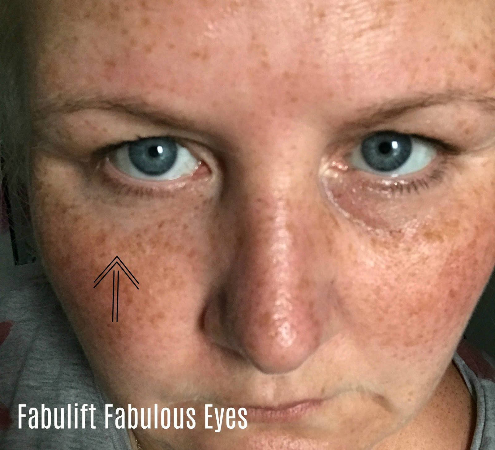 Fabulift Fabulous Eyes Eye Lifting Serum Including Before And After