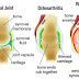 Natural Home Remedy For Athritis