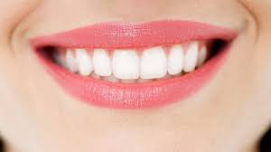 Những ưu điểm khi bọc răng sứ cercon Nhung-uu-diem-khi-boc-rang-su-cercon-01