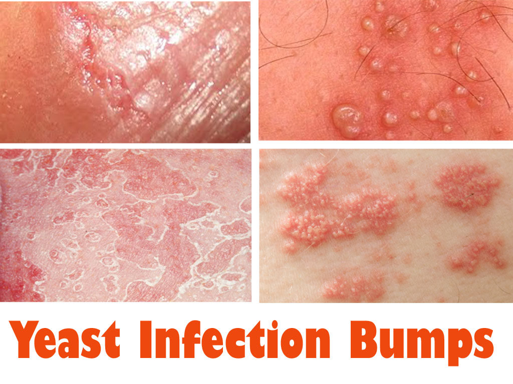 woman from movie aliens naked vaginal yeast infection natural cure