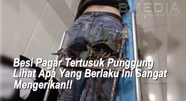 Besi Pagar Tertusuk Punggung Lihat Apa Yang Berlaku Ini Besi Pagar Tertusuk Punggung Lihat Apa Yang Berlaku Ini