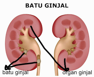 obat kencing batu ginjal, obat kencing batu atau batu ginjal, obat batu ginjal di saluran kencing, obat kencing batu/batu ginjal, obat kencing batu dan ginjal obat kencing batu ginjal, obat kencing batu atau batu ginjal, obat batu ginjal di saluran kencing, obat kencing batu/batu ginjal, obat kencing batu dan ginjal