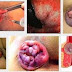 Obat Untuk Ambeien Luar thumbnail