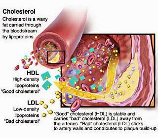 Cara Menurunkan Kolesterol Tinggi Secara Alami