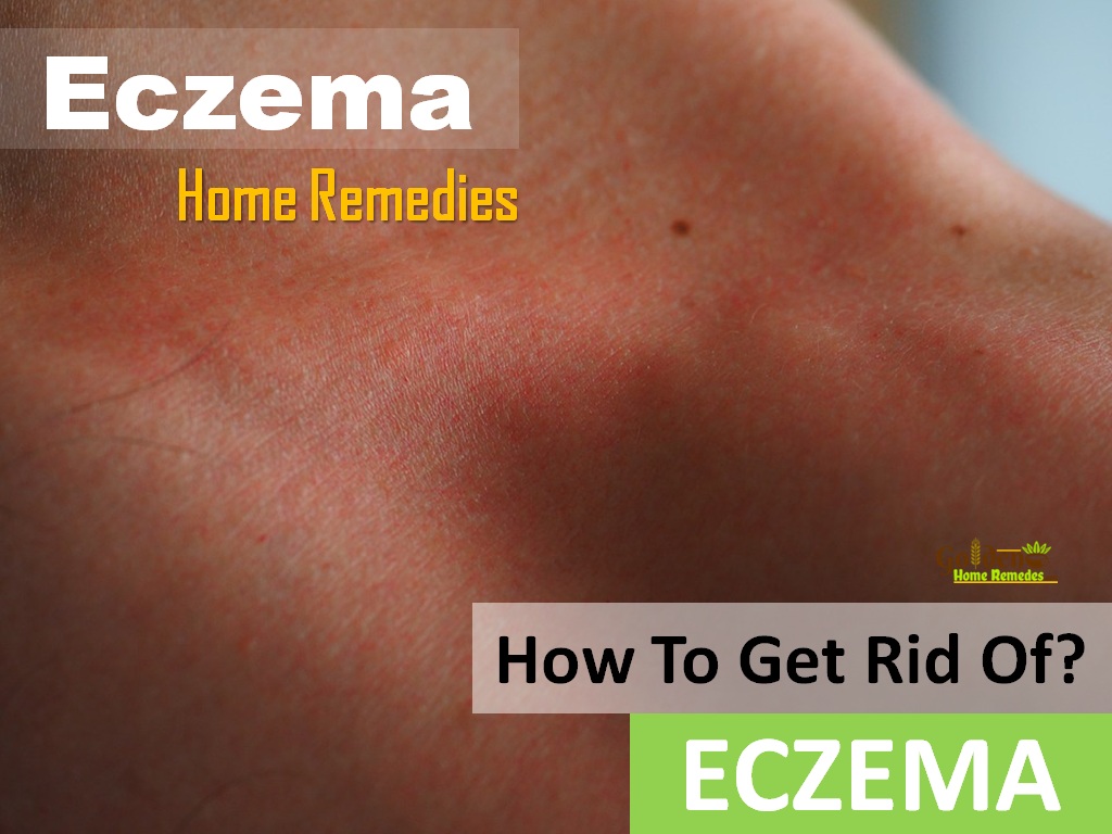 26 healing home remedies for eczema golden home remedies