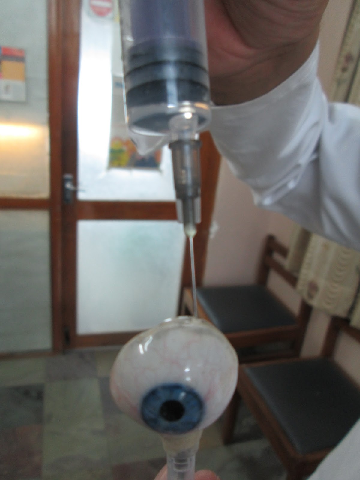 SelfLubricating Ocular Prosthesis Kolkata, West Bengal Self