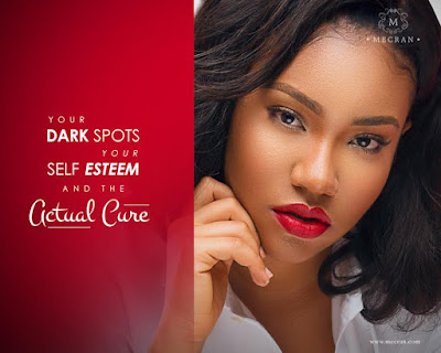 Your Dark Spots, Your Self Esteem, and the Actual Cure