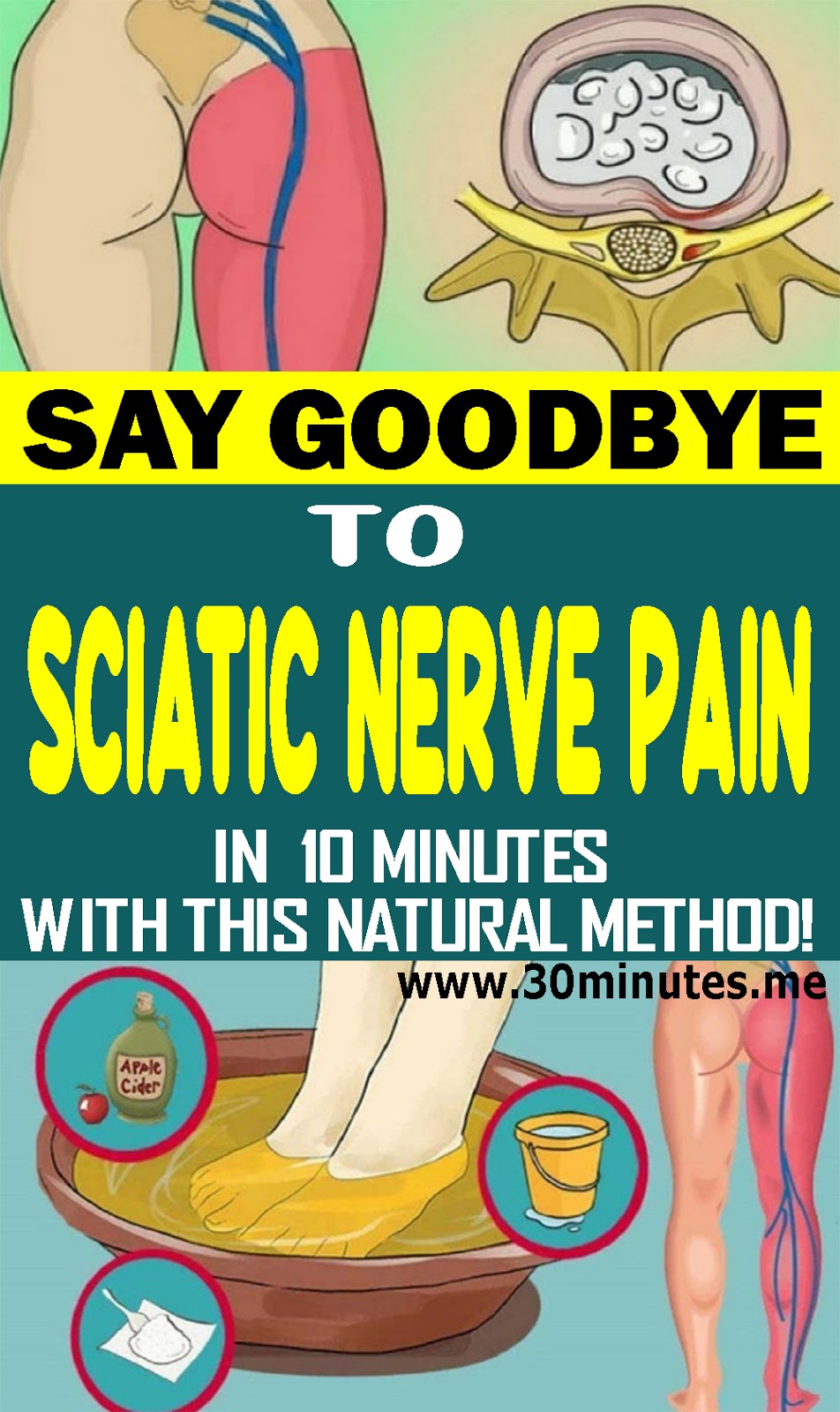 Say Goodbye To Sciatic Nerve Pain In 10 Minutes With This Natural