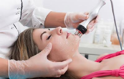Laser Treatment for Acne Laser Treatment for Acne