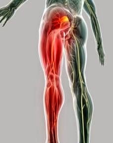 próstata y piernas pesadas y dolor de espalda sordo