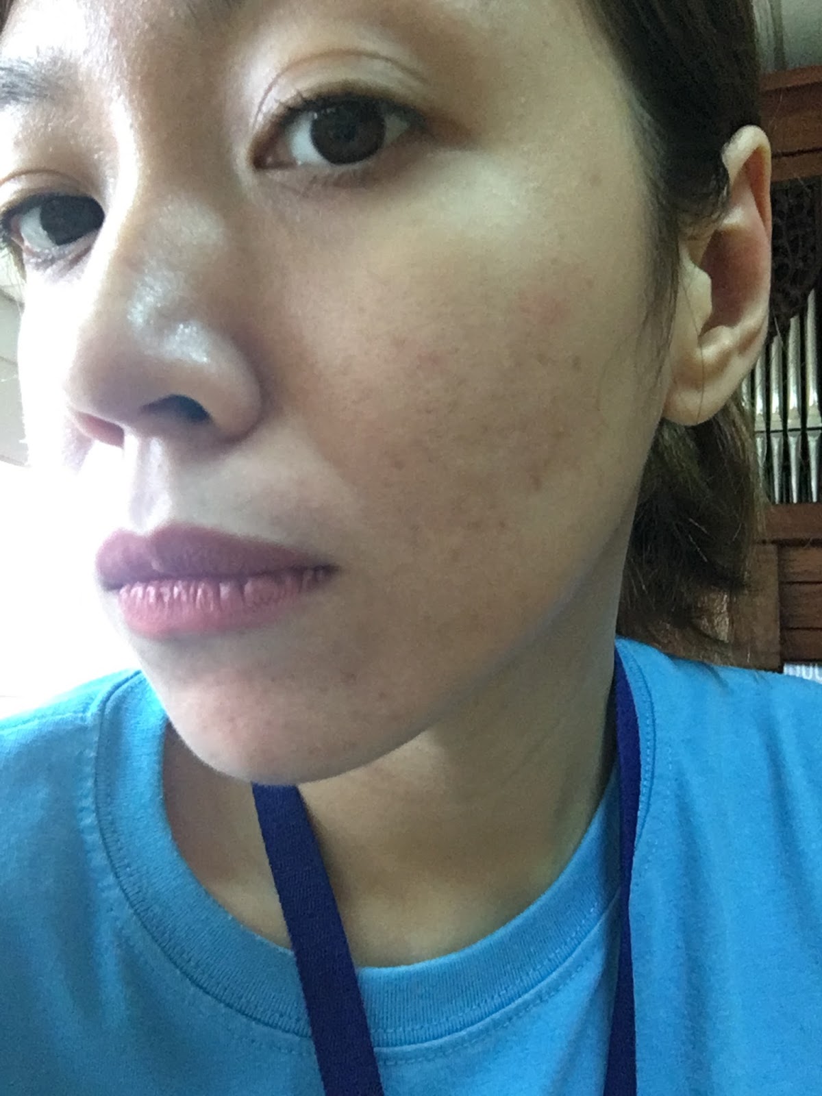 revlite skin 101 price