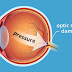 Glaucoma: peruano patenta técnica e instrumental nuevo en EE.UU.