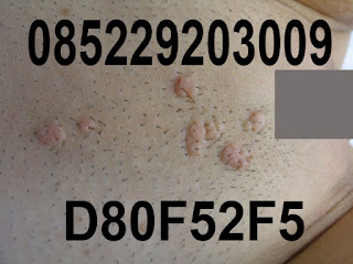 Obat Kutil Mengobati Kutil, Mengatasi Kutil, Menyembuhkan Kutil, Menghilangkan Kutil, Penghilang Kutil, Penghapus Kutil, Perontok Kutil, Obat Kutil Kelamin, Cara & Tips Menghilangkan Kutil 1 Malam Hilang, Menghilangkan Kutil Kelamin Dari Rumah Sendiri Jangka 3 Hari, Obat Kutil Manjur, Obat Kutil Kelamin Pria, Obat Kutil Kelamin Wanita, Obat Kutil Kelamin Untuk Zakar / Ubat Ketuat Di Kemaluan Kelamin Penis Pria, Obat Kutil Kelamin Laki-Laki, Obat Kutil Kelamin Perempuan, Obat Kutil Kelamin Ibu Hamil (Menyusui / Mengandung), Obat Kutil Herbal, Obat Kutil Mujarab, Obat Kutil Alami, Obat Kutil Di Apotek, Obat Kutil Di Dubur / Anus, Obat Kutil Di Paha, Obat Kutil Di Apotik, Obat Kutil Di Dalam / Luar Vagina, Obat Kutil Di Badan Lainnya, Obat Kutil Kelamin Anak-Anak, Krim Kutil, Obat Kutil Ampuh, Obat Kutil Kelamin Tanpa Operasi Terbukti Keampuhannya, Cream Kutil, Salep Untuk Kutil, Obat Oles Buat Kutil, Obat Penghilang Kutil Pada Kulit Yang Terbukti Aman Tanpa Efek Samping Serta Terpercaya.0852-2920-3009 BBM: D80F52F5. Obat Kutil Mengobati Kutil, Mengatasi Kutil, Menyembuhkan Kutil, Menghilangkan Kutil, Penghilang Kutil, Penghapus Kutil, Perontok Kutil, Obat Kutil Kelamin, Cara & Tips Menghilangkan Kutil 1 Malam Hilang, Menghilangkan Kutil Kelamin Dari Rumah Sendiri Jangka 3 Hari, Obat Kutil Manjur, Obat Kutil Kelamin Pria, Obat Kutil Kelamin Wanita, Obat Kutil Kelamin Untuk Zakar / Ubat Ketuat Di Kemaluan Kelamin Penis Pria, Obat Kutil Kelamin Laki-Laki, Obat Kutil Kelamin Perempuan, Obat Kutil Kelamin Ibu Hamil (Menyusui / Mengandung), Obat Kutil Herbal, Obat Kutil Mujarab, Obat Kutil Alami, Obat Kutil Di Apotek, Obat Kutil Di Dubur / Anus, Obat Kutil Di Paha, Obat Kutil Di Apotik, Obat Kutil Di Dalam / Luar Vagina, Obat Kutil Di Badan Lainnya, Obat Kutil Kelamin Anak-Anak, Krim Kutil, Obat Kutil Ampuh, Obat Kutil Kelamin Tanpa Operasi Terbukti Keampuhannya, Cream Kutil, Salep Untuk Kutil, Obat Oles Buat Kutil, Obat Penghilang Kutil Pada Kulit Yang Terbukti Aman Tanpa Efek Samping Serta Terpercaya.0852-2920-3009 BBM: D80F52F5.
