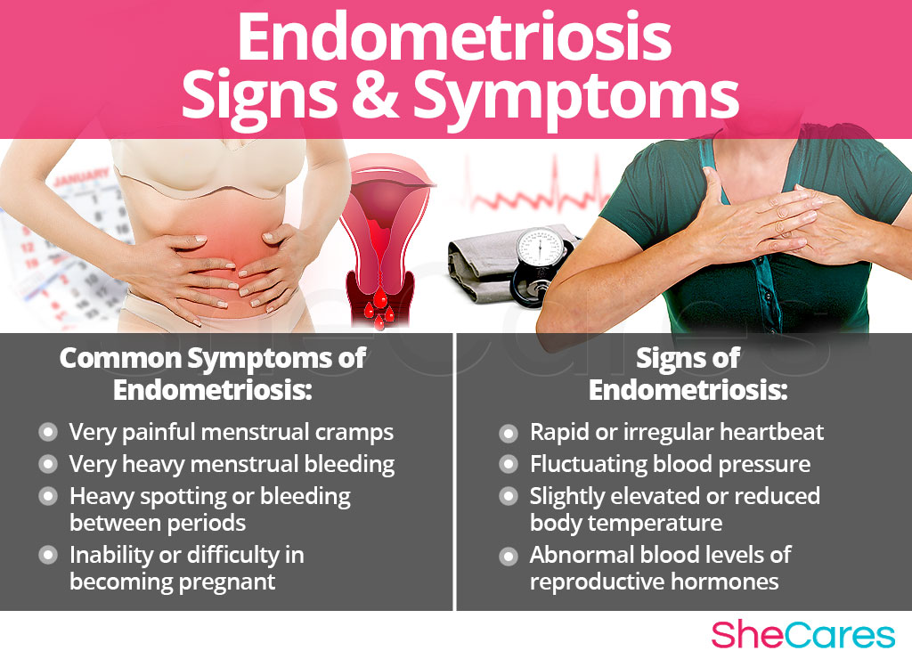 Can You Develop Endometriosis After A Baby?