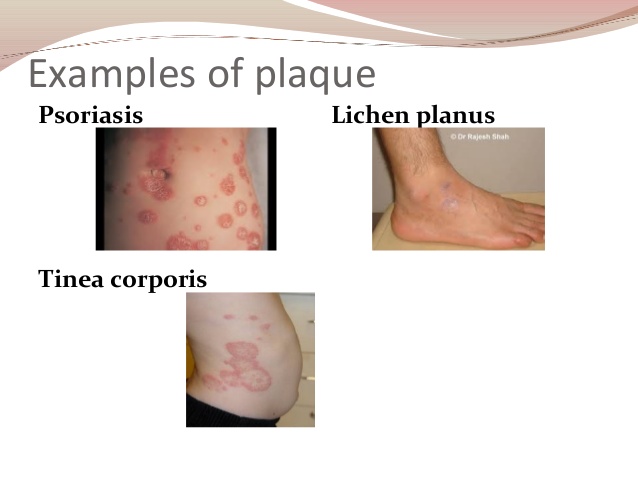 study-medical-photos-description-of-primary-skin-lesions