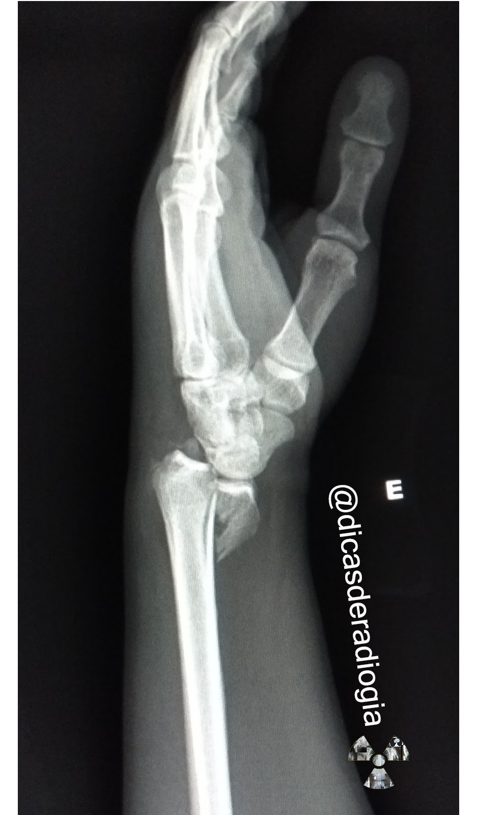 DICAS DE RADIOLOGIA Tudo Sobre Radiologia