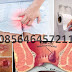 Ambejoss Obat Wasir Herbal's Denature thumbnail