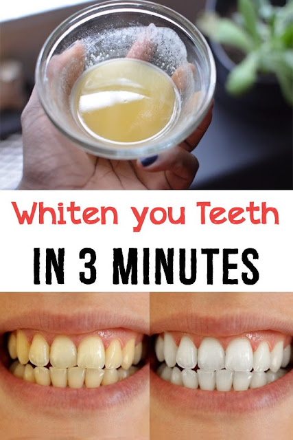 Whiten your teeth in 3 minutes