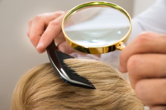 What is Itchy Scalp and what can you do about it? 3