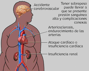 Dieta para la obesidad Dieta para la obesidad