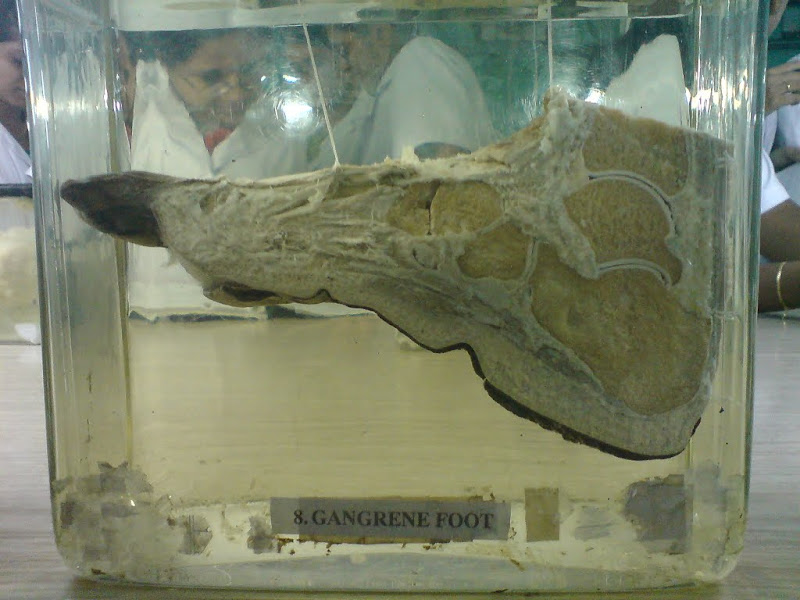 Deformutilation Wet Specimens