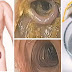 Here Are Ways to Successfully Remove Toxins in your Colon