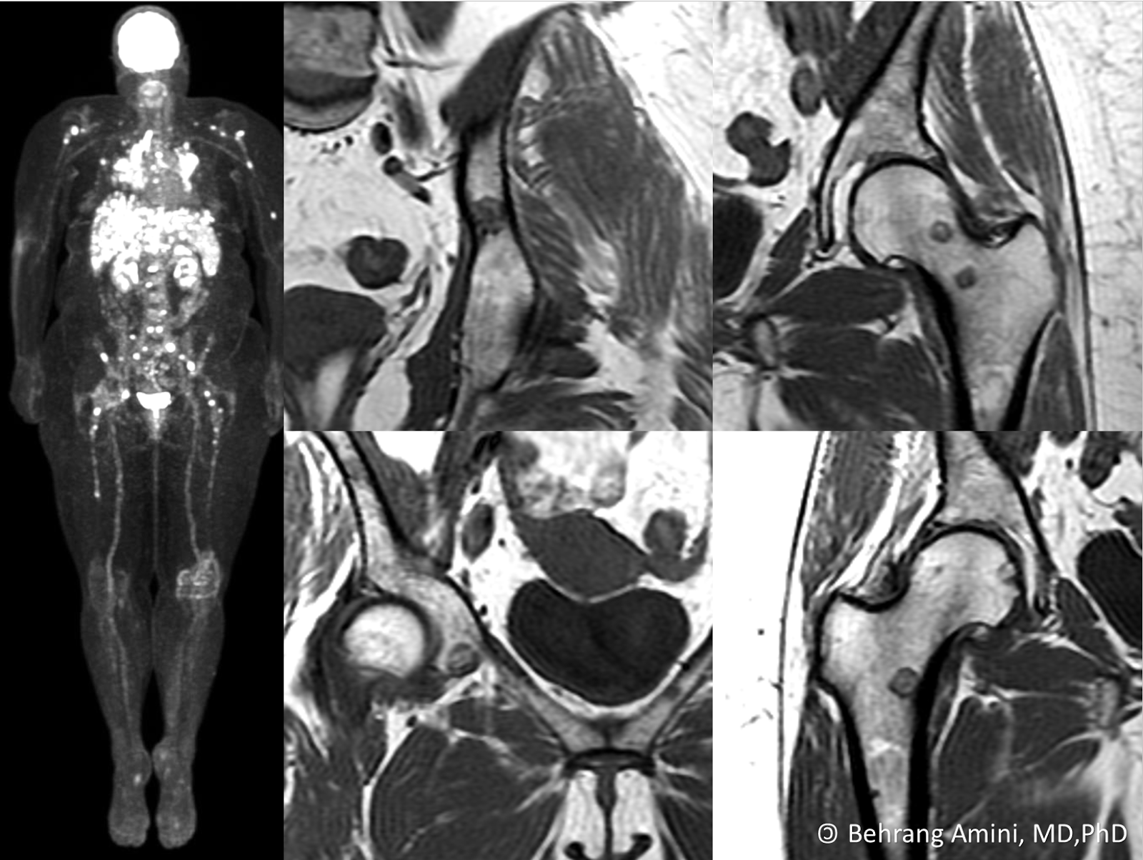 Roentgen Ray Reader March 2017
