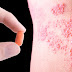 THIS Vitamin Outperforms The Shingles Vaccine