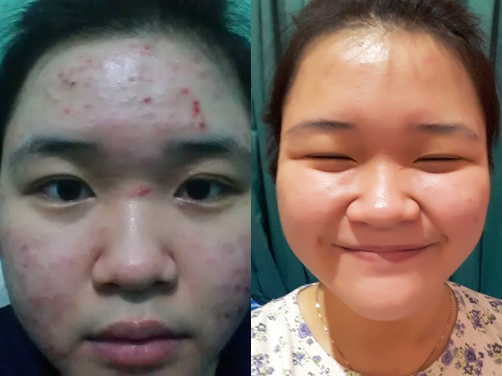 Halo Helo Hola: Review Klinik Estetika Dr. Janet - Pademangan
